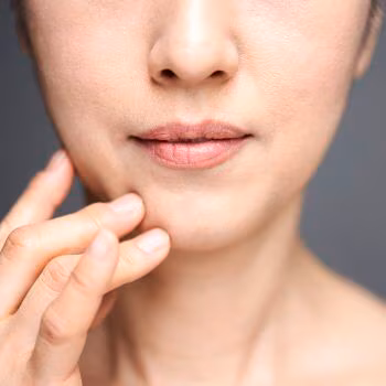 Kulit Wajah Kering dan Kasar Bikin Nggak Pede? Ini Rahasia Mengembalikannya