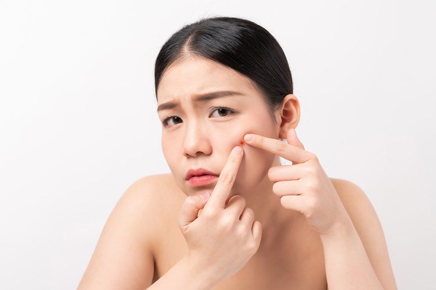 Facial Acne, Perawatan Favorit untuk Kulit Berjerawat