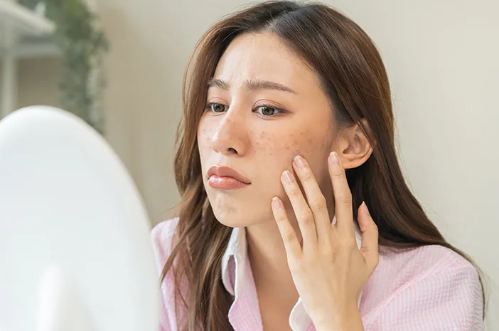 Kulit Kering dan Kusam? Ini Tips Perawatan yang Bisa Kamu Lakukan