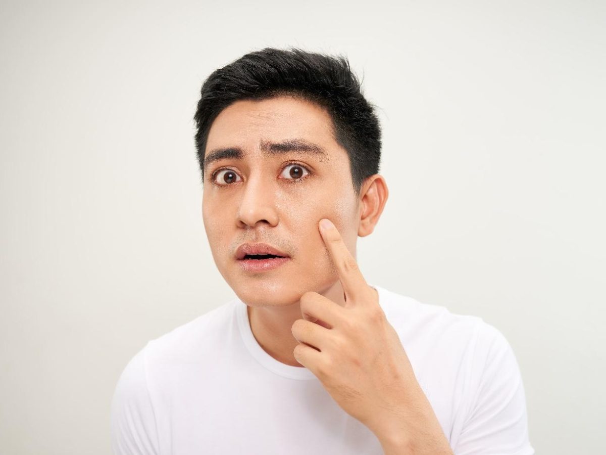 Kulit Sering Mengkilap? Ini Tanda Kamu Punya Kulit Berminyak