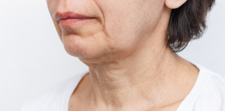 Wajah Mulai Kendur? Kenali Penyebabnya Sebelum Terlambat