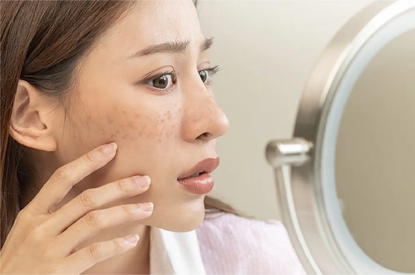 Flek Hitam di Wajah: Penyebab, Cara Mencegah, dan Solusi Efektif